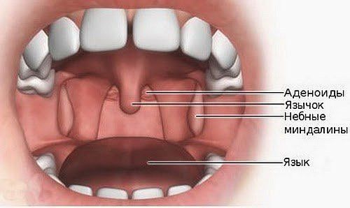 adenoidy